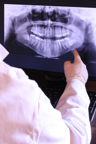 Emergency Dental Filling Replacement in TN