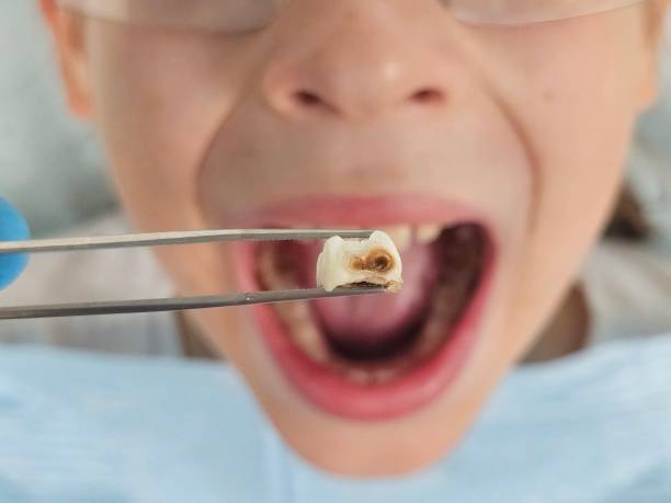 Best Emergency Gum Pain Relief  in Pine Crest, TN