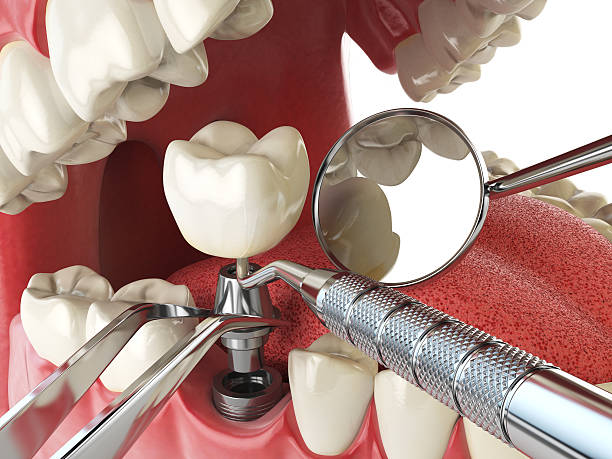 Best Emergency Tooth Extraction  in Pine Crest, TN